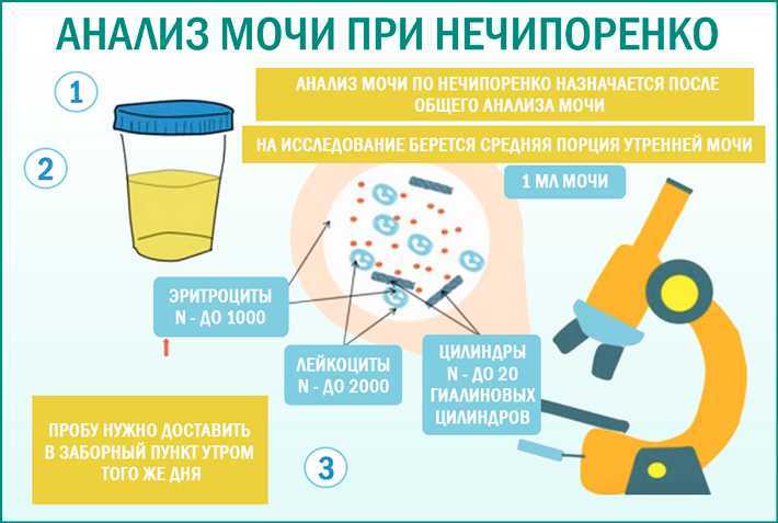 Анализ мочи на лейкоциты