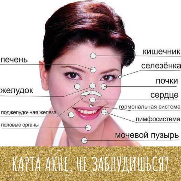Просянка (белые угри, милиумы) – причины появления, лечение, профилактика