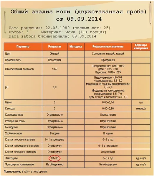 Способы сбора мочи у кошки для анализов