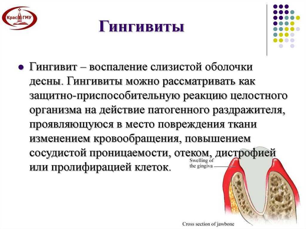 Гастроэзофагеальная рефлюксная болезнь: новый подход к причинам и лечению * клиника диана в санкт-петербурге