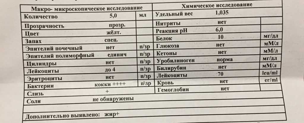 Анализ мочи у кошек: общие показатели нормы и отклонения, методы сбора мочи, расшифровка, особенности