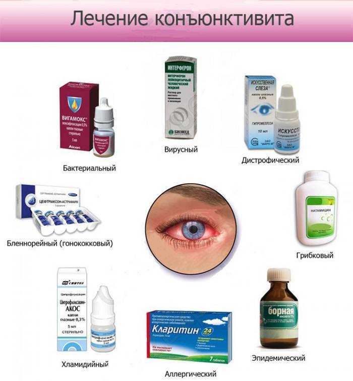 Лечение аллергического ринита и кашля, диагностика заболевания, профилактические меры