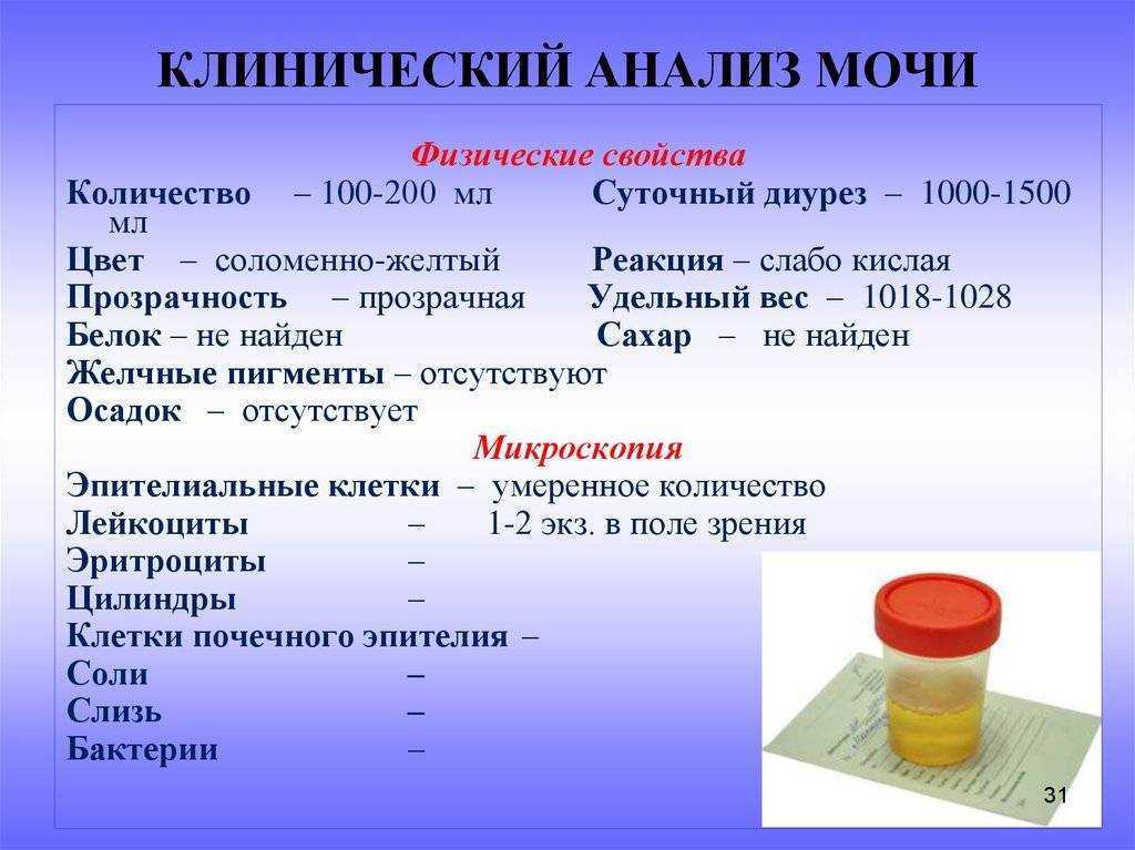 Как понять результаты анализа мочи?