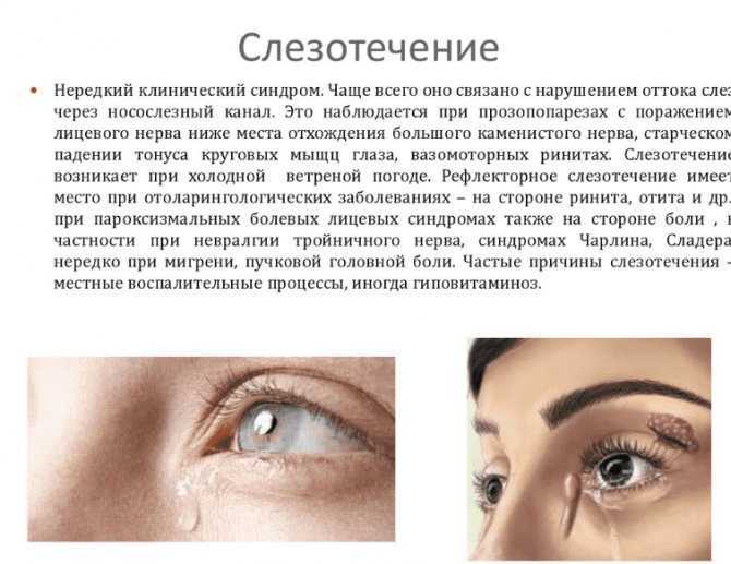 Как вылечить сопли у собаки должен знать каждый владелец