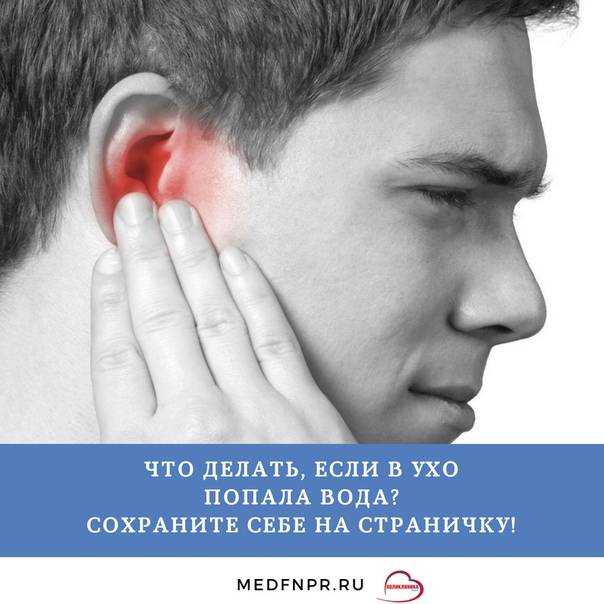 Как выглядит серная пробка в ухе и как избавиться от нее — лечение и удаление дома